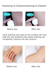 Silicone Electric Facial Cleansing Brush Vibration Face Cleaner